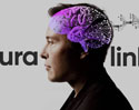 Neuralink เทคโนโลยีฝังชิปในสมองของ Elon Musk เตรียมนำมาใช้กับมนุษย์ในอีก 6 เดือนข้างหน้า