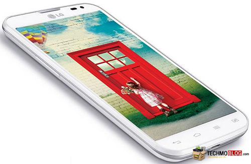 รูปภาพ  LG L70 Dual (แอลจี L70 Dual)