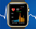 ตรวจหาโรคหัวใจแต่เนิ่นๆ ด้วย Apple Watch ผ่านแอป Cardiogram วินิจฉัยได้แม่นยำถึง 97% ฝีมือทีมวิจัยจากมหาวิทยาลัยแคลิฟอร์เนีย
