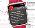 นักศึกษาพยาบาล แนะให้ผู้ใช้เปิดแจ้งเตือนการเต้นของหัวใจบน Apple Watch หลังตรวจจับอาการของโรคไทรอยด์ได้ก่อนแพทย์ตรวจพบ 