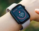 Apple Watch ช่วยชีวิตสาววัย 29 ร้องเตือนหัวใจเต้นเร็วผิดปกติ ก่อนตรวจพบมีลิ่มเลือดอุดตันในปอด